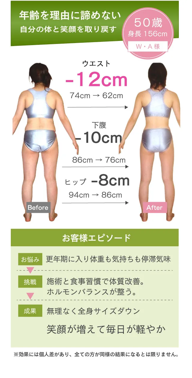 年齢を理由に諦めない。自分の体と笑顔を取り戻す。50歳。身長156cm。W・A様W・A様。ウエスト-12cm（74cm→662cm）下腹-10cm（86cm→76cm）ヒップ-8cm（94cm→86cm。お客様エピソード。【お悩み】更年期に入り体重も気持ちも停滞気味→【挑戦】施術と食事習慣で体質改善。ホルモンバランスが整う。→【成果】無理なく全身サイズダウン。笑顔が増えて毎日が軽やか。